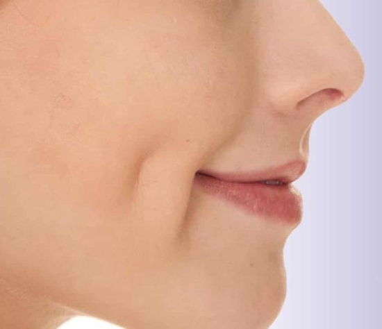 Dimple Creation in Noida