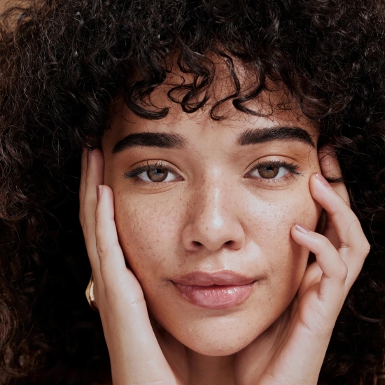 Hyperpigmentation in Noida 